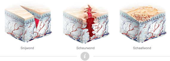 Wondgenezing | Algemeen | Menselijk Lichaam - Menselijk Lichaam